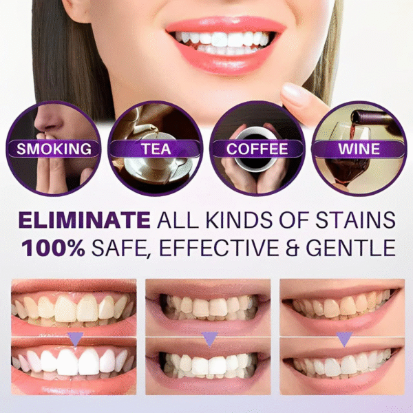 HiSmile Color Corrector Serum – Purple Teeth Whitening Serum for Safe, Gentle Brightening & Stain Removal - Image 3